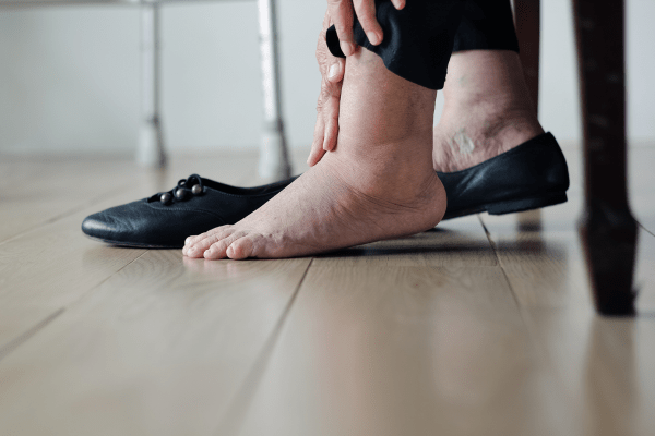 remède de grand mère pour les pieds gonflés
