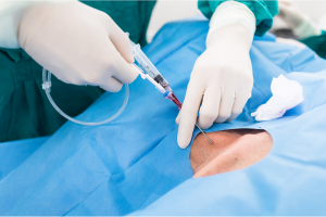 combien de stents peut-on recevoir