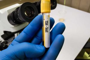 tsh prise de sang à je